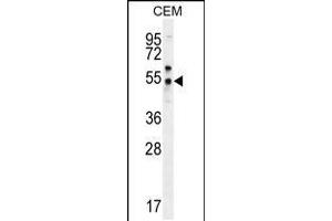 Western blot analysis in CEM cell line lysates (35ug/lane). (FOLH1B Antikörper  (C-Term))