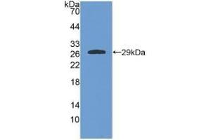 Detection of Recombinant GSTa4, Rat using Polyclonal Antibody to Glutathione S Transferase A4 (GSTA4) (GSTA4 Antikörper  (AA 2-222))