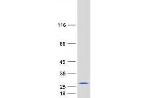 Western Blotting (WB) image for Chromobox Homolog 3 (CBX3) (Transcript Variant 2) protein (Myc-DYKDDDDK Tag) (ABIN2713263)
