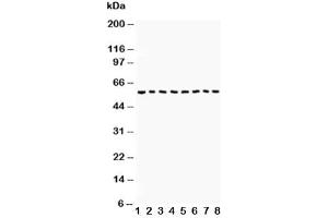 Western blot testing of Beclin 1 antibody and Lane 1:  COLO320 (Beclin 1 Antikörper  (AA 1-354))