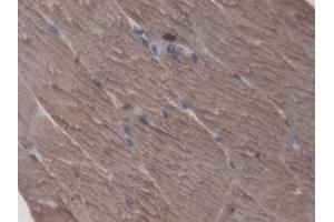 Detection of CKM in Porcine Skeletal muscle Tissue using Polyclonal Antibody to Creatine Kinase, Muscle (CKM) (CKM Antikörper  (AA 11-367))