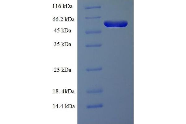 RMND5A Protein (AA 1-385, full length) (His-SUMO Tag)