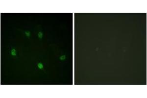 Immunofluorescence analysis of HeLa cells, using Cyclin E1 (Ab-77) Antibody. (Cyclin E1 Antikörper  (AA 43-92))