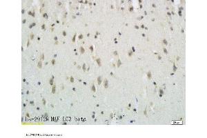 Formalin-fixed and paraffin embedded rat brain tissue labeled with Anti-LC3B/MAP LC3β/MAP1A Polyclonal Antibody, Unconjugated  followed by conjugation to the secondary antibody and DAB staining (MAP1LC3A/B Antikörper  (AA 21-121))