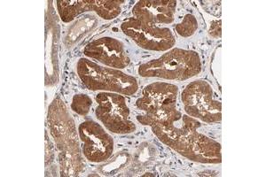 Immunohistochemical staining of human kidney with CXorf27 polyclonal antibody  shows strong cytoplasmic positivity in cells in tubules. (Chromosome X Open Reading Frame 27 (CXORF27) Antikörper)