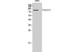 anti-Stonin 1 (STON1) (AA 660-740) antibody