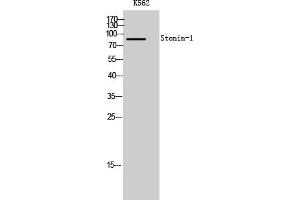 Western Blot analysis of K562 cells using Stonin-1 Polyclonal Antibody. (STON1 Antikörper  (AA 660-740))