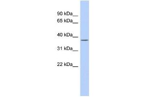 WB Suggested Anti-SIRT6 Antibody Titration:  0.