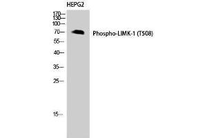 Western Blotting (WB) image for anti-LIM Domain Kinase 1 (LIMK1) (pThr508) antibody (ABIN3172924) (LIM Domain Kinase 1 Antikörper  (pThr508))