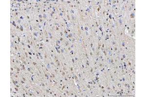 IHC analysis of RGS12 using anti-RGS12 antibody (ABIN7602410). (RGS12 Antikörper  (AA 746-995))