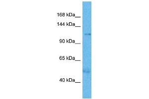 Host:  Rabbit  Target Name:  UTY  Sample Type:  Thyroid Tumor lysates  Antibody Dilution:  1. (UTY Antikörper  (N-Term))