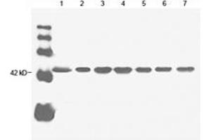 Image no. 1 for anti-Actin, beta (ACTB) antibody (ABIN2614157) (beta Actin Antikörper)