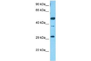 Host:  Rabbit  Target Name:  SCRT2  Sample Type:  HCT116 Whole Cell lysates  Antibody Dilution:  1.