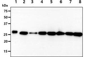The recombinant protein (50ng) and cell lysates (40ug) were resolved by SDS-PAGE, transferred to PVDF membrane and probed with anti-human PGAM2 antibody (1:1000). (PGAM2 Antikörper)