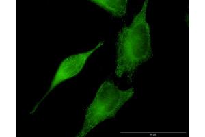 Immunofluorescence of monoclonal antibody to SEPT8 on HeLa cell. (Septin 8 Antikörper  (AA 1-258))