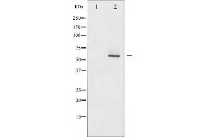 Western blot analysis of Akt2 phosphorylation expression in TNF-α treated A2780 whole cell lysates,The lane on the left is treated with the antigen-specific peptide. (AKT2 Antikörper  (pSer474))