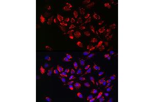 Immunofluorescence analysis of U-2 OS cells using [KO Validated] Hexokinase II Rabbit pAb (ABIN3021255, ABIN3021256, ABIN3021257 and ABIN6214088) at dilution of 1:100 (40x lens). (Hexokinase 2 Antikörper  (AA 1-120))