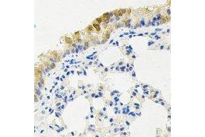 Immunohistochemical analysis of KIF2B staining in mouse lung formalin fixed paraffin embedded tissue section. (KIF2B Antikörper)