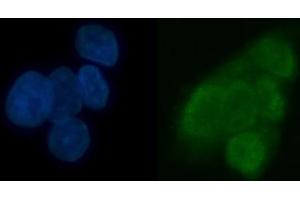 IF analysis of TRMT6 using anti-TRMT6 antibody (ABIN7602138).