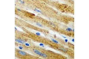 Immunohistochemical analysis of CARS staining in mouse heart formalin fixed paraffin embedded tissue section. (CARS Antikörper)