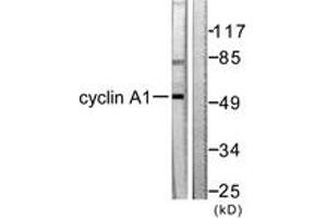 Western blot analysis of extracts from SKOV3 cells, using Cyclin A1 Antibody. (Cyclin A1 Antikörper  (AA 411-460))