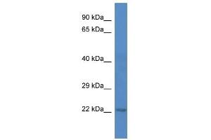 Western Blot showing 5730409E04Rik antibody used at a concentration of 1.