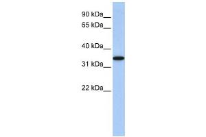 Western Blotting (WB) image for anti-ADP-Ribosyltransferase 4 (Dombrock Blood Group) (ART4) antibody (ABIN2458668)