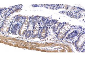 Detection of MYH11 in Rat Colon Tissue using Polyclonal Antibody to Myosin Heavy Chain 11, Smooth Muscle (MYH11) (MYH11 Antikörper  (AA 1-351))