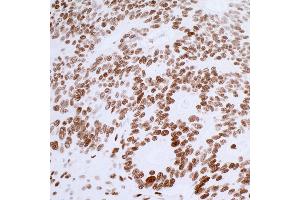 anti-Tumor Protein P53 Binding Protein 1 (TP53BP1) (AA 350-400) antibody