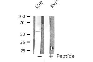 Western blot analysis of extracts from K562 cells, using INA antibody. (INA Antikörper  (Internal Region))