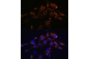 Immunofluorescence analysis of NIH-3T3 cells using DR5/TR/TNFRSF10B Rabbit mAb (ABIN7271062) at dilution of 1:100 (40x lens). (TNFRSF10B Antikörper)