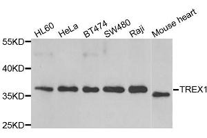 Western blot analysis of extracts of various cell lines, using TREX1 antibody. (TREX1 Antikörper  (AA 1-270))