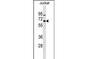 ZN Antibody (N-term) (ABIN1882022 and ABIN2838605) western blot analysis in Jurkat cell line lysates (35 μg/lane). (ZNF358 Antikörper  (N-Term))