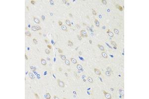Immunohistochemistry of paraffin-embedded rat brain using CRABP2 antibody (ABIN1882301) at dilution of 1:100 (40x lens). (CRABP2 Antikörper)