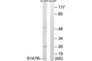 Western blot analysis of extracts from HuvEc cells, using S100A7L2 Antibody.