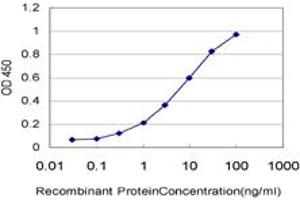 Detection limit for recombinant GST tagged PADI2 is approximately 0.