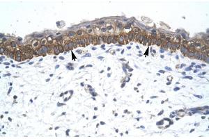 Human Skin; ZNF385 antibody - C-terminal region in Human Skin cells using Immunohistochemistry (ZNF385A Antikörper  (C-Term))