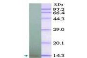 Image no. 2 for anti-Chemokine (C-X-C Motif) Ligand 10 (CXCL10) antibody (ABIN791563) (CXCL10 Antikörper)