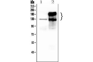 Western blot analysis of CEACAM5 using anti-CEACAM5 antibody (ABIN7601435).