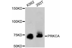 Western blot analysis of extracts of various cell lines, using PRKCA antibody (ABIN5997085). (PKC alpha Antikörper)