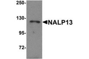 NLRP13 抗体  (N-Term)