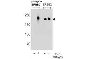 Western blot analysis of extracts from A431 cells, untreated or treated with EGF (100ng/ml) using p-ERBB2 antibody (left) or nonphos Ab (right) (ErbB2/Her2 Antikörper  (pTyr1196))