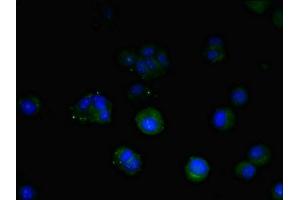 Immunofluorescent analysis of MCF-7 cells using ABIN7172947 at dilution of 1:100 and Alexa Fluor 488-congugated AffiniPure Goat Anti-Rabbit IgG(H+L) (TM9SF1 Antikörper  (AA 28-230))