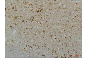 Immunohistochemical analysis of paraffin-embedded Rat Brain Tissue using Cav1. (CACNA1D Antikörper)