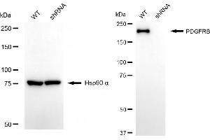 Western blotting analysis using PDGFRB antibody (ABIN7799848).