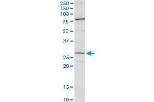 CFDP1 polyclonal antibody (A01). (CFDP1 Antikörper  (AA 168-251))