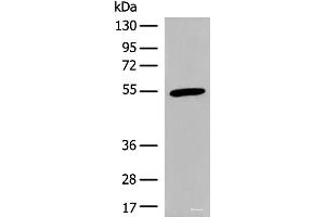 Western blot analysis of Human heart tissue lysate using CIR1 Polyclonal Antibody at dilution of 1:600 (CIR1 Antikörper)