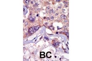 Immunohistochemistry (Paraffin-embedded Sections) (IHC (p)) image for anti-Lymphocyte-Specific Protein tyrosine Kinase (LCK) (AA 23-52), (N-Term) antibody (ABIN392101)