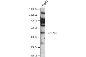 Western blot analysis of extracts of various cell lines, using ZNF763 antibody (ABIN7271529) at 1:1000 dilution. (ZNF763 Antikörper  (AA 315-370))