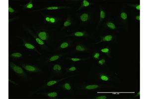Immunofluorescence of purified MaxPab antibody to NFATC2IP on HeLa cell. (NFATC2IP Antikörper  (AA 1-138))